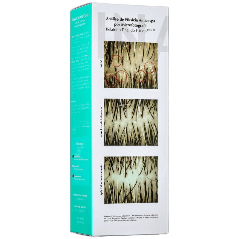 Ada Tina Amplexe Anticaspa Oleosa - Shampoo 200ml
