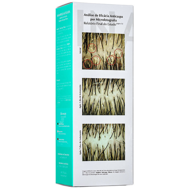 Ada Tina Amplexe Anticaspa Oleosa - Shampoo 200ml