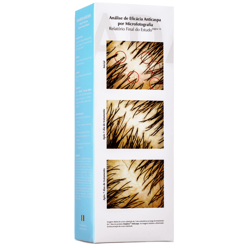 Ada Tina Amplexe Anticaspa Seca - Shampoo 200ml