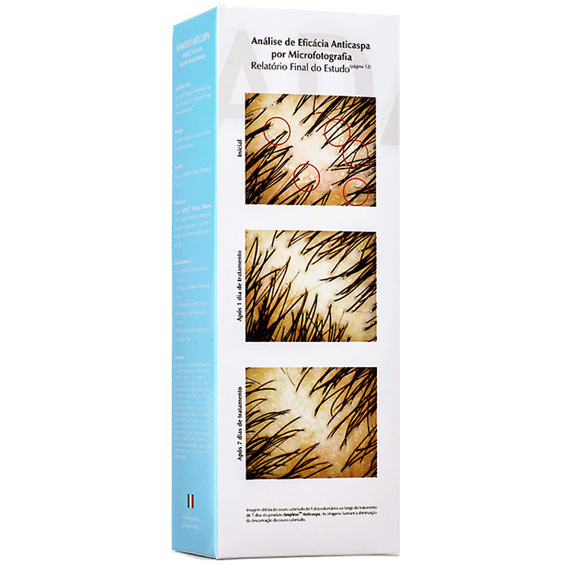 Ada Tina Amplexe Anticaspa Seca - Shampoo 200ml